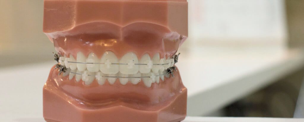 orthodontic emergencies san dimas
