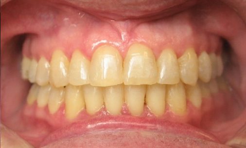 after10 Abari Orthodontics and Oral Surgery
