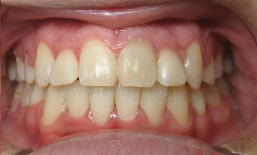 after11 Abari Orthodontics and Oral Surgery
