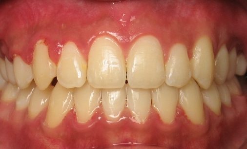 after2 Abari Orthodontics and Oral Surgery - before & after