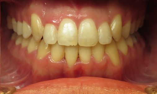 after7 Abari Orthodontics and Oral Surgery - before & after