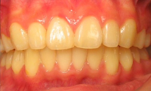 after8 Abari Orthodontics and Oral Surgery