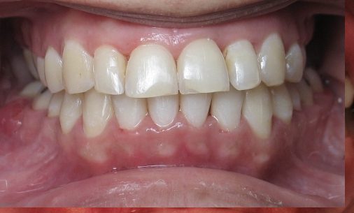 after9 Abari Orthodontics and Oral Surgery - before & after