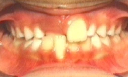 before3 1 Abari Orthodontics and Oral Surgery