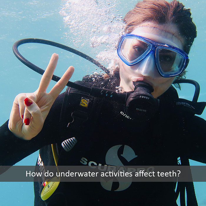 underwater teeth 2022 700 Abari Orthodontics and Oral Surgery