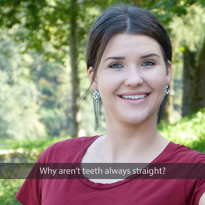 why crooked teeth 2022 700 Abari Orthodontics and Oral Surgery -