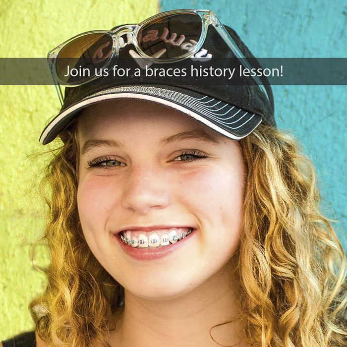 braces history 2022 700 Abari Orthodontics and Oral Surgery -