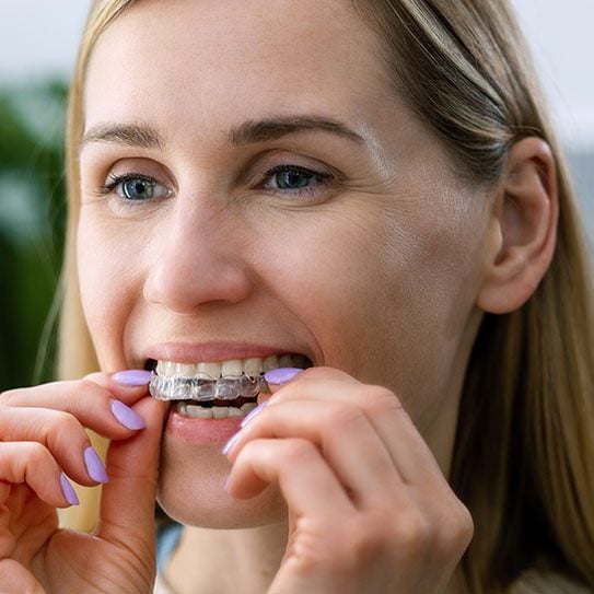 clear aligners near me