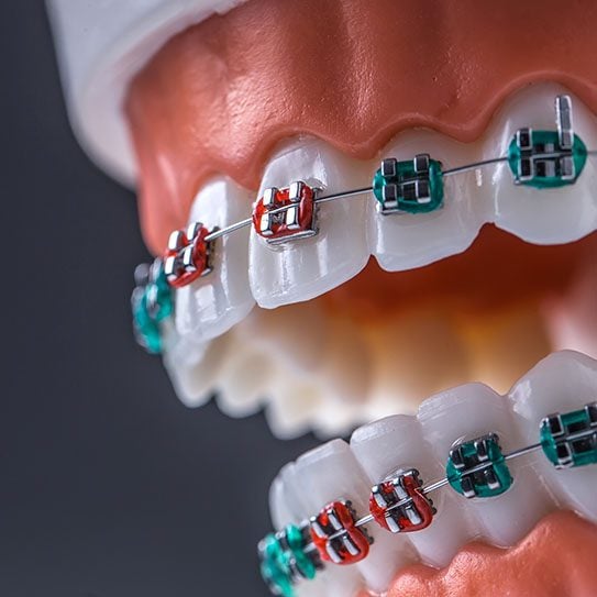 Braces near me orthodontist