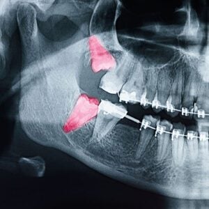 orthodontist san dimas
