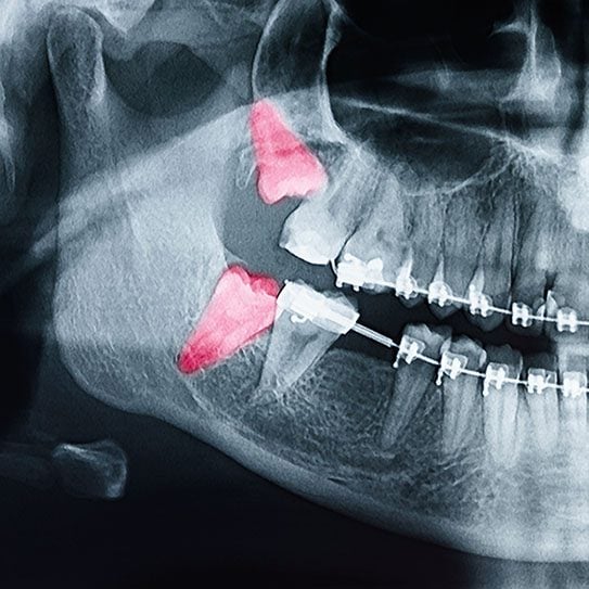 orthodontist san dimas