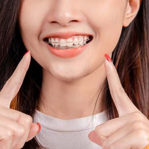 orthodontist san dimas