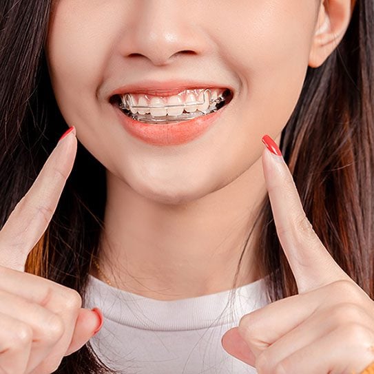orthodontist san dimas
