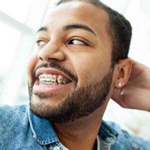 orthodontist san dimas