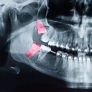 orthodontist san dimas
