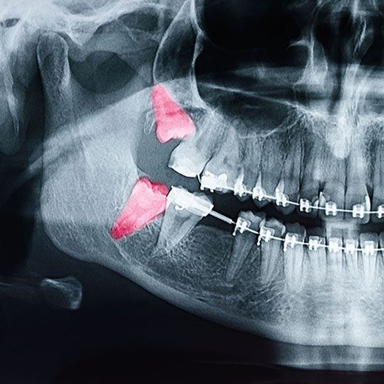 orthodontist san dimas