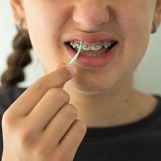 orthodontist san dimas