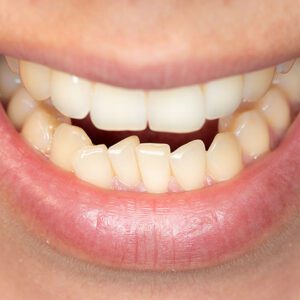 orthodontist san dimas