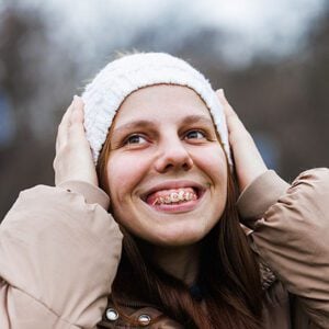 orthodontist san dimas