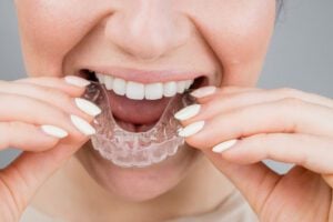 Invisalign in San Dimas