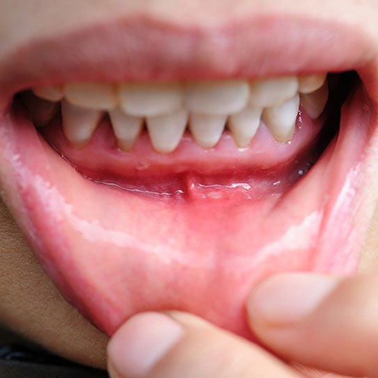 orthodontist san dimas